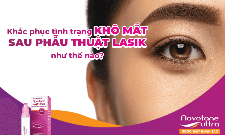 Khắc phục tình trạng khô mắt sau phẫu thuật Lasik như thế nào?