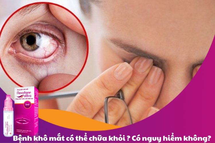 Bệnh khô mắt có thể chữa khỏi? Có nguy hiểm không?