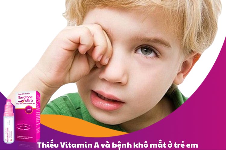 Thiếu vitamin A và bệnh khô mắt ở trẻ em